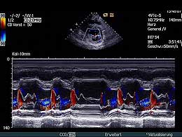 kurze-Achse-M-Mode-Mitralklappe