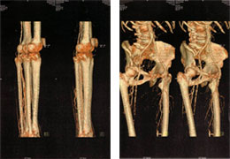 Angiographie der Gefässe